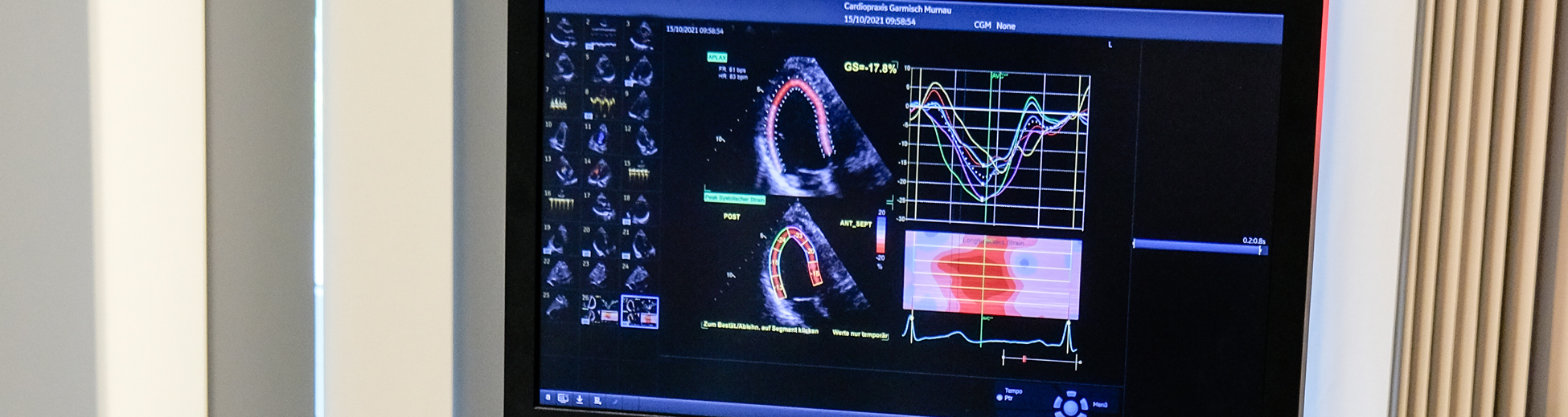 Cardiopraxis Garmisch Murnau Cardiologie